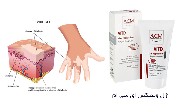 acm vitix.jpg