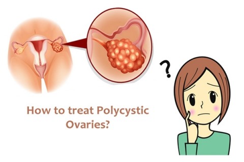 b2ap3_thumbnail_How-to-Cure-PCOS.jpg