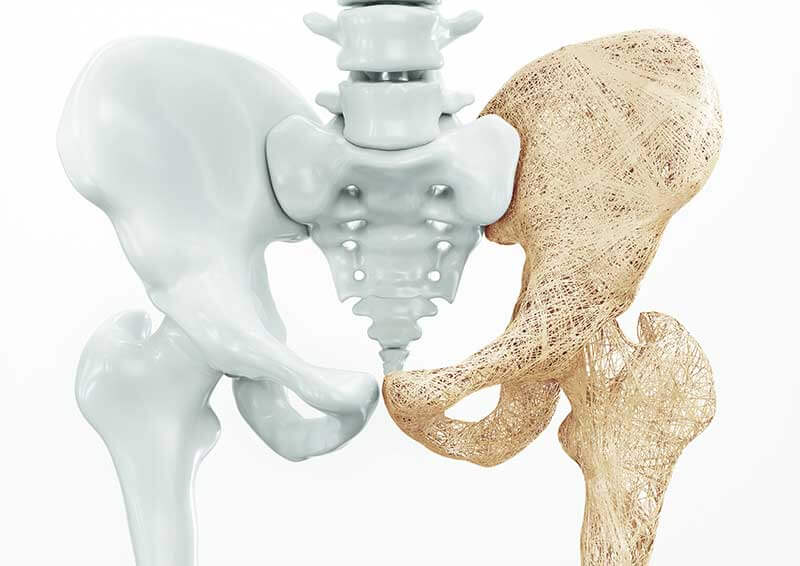 new-study-shows-long-term-sleep-deprivation-could-lead-to-osteoporosis.jpg