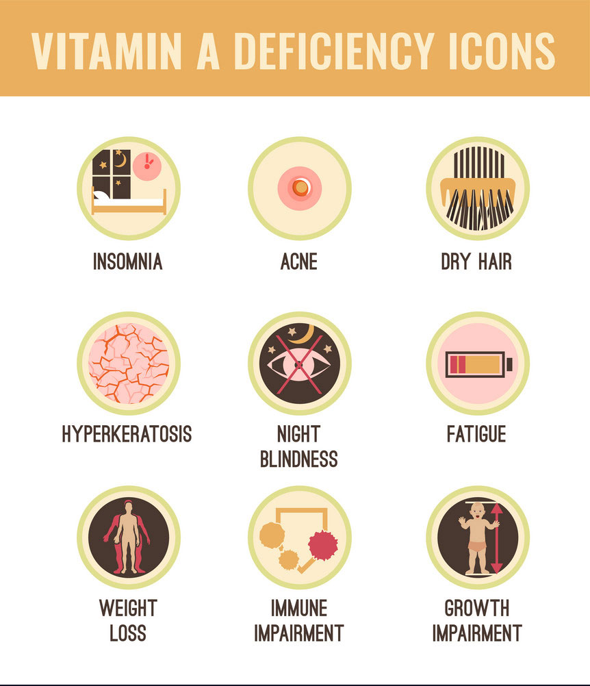 vitamin-a-deficiency-icons-set-vector-20985409_0.jpg
